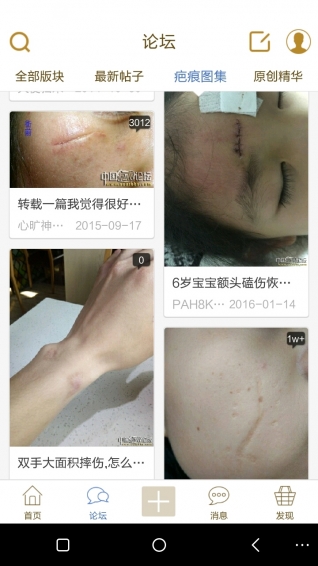 中國疤痕論壇官方下載 v1.1.51 安卓版圖1
