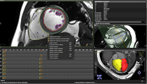 心血管后期處理軟件
