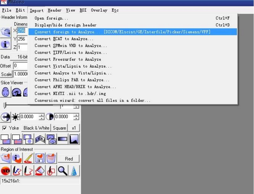 mriCroN醫(yī)學(xué)影像分析軟件下載